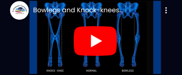 Fingertip Injuries Treatment